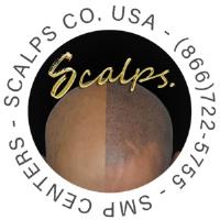 SCALPS | Scalp Micropigmentation Centers image 1
